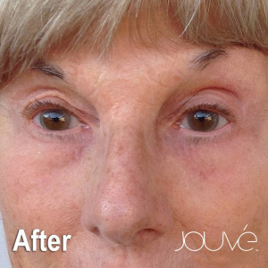 Jouve-Heshie-After